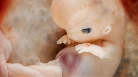 Estas impactantes imu00e1genes demuestran que la vida humana comienza en la concepciu00f3n [FOTOS]