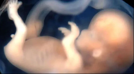 Revelan falacias de proyecto para despenalizar aborto hasta la semana 14 en Chile