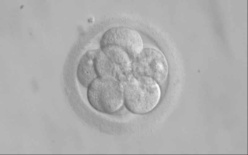 Embriu00f3n humano. Foto: Wikimedia Commons?w=200&h=150